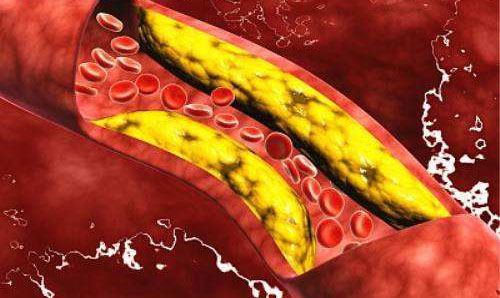 �ܵ��̴�������ô���� ���̴��ߵ�ԭ��